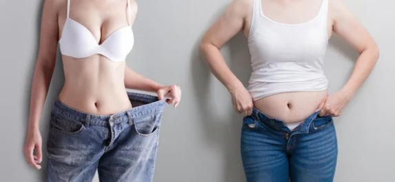 liposuction before/after